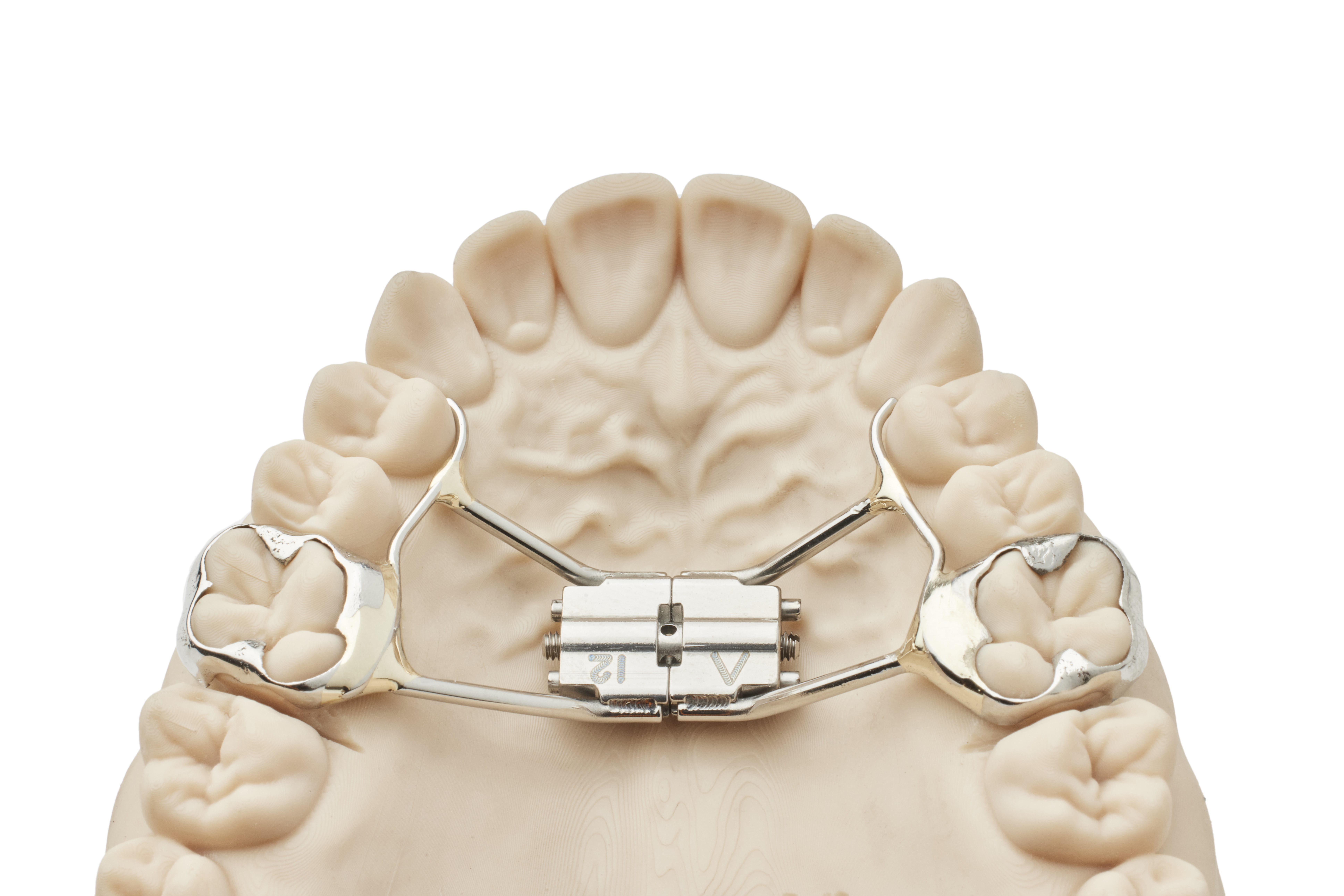 orthodontic teeth model demonstrating dental alignment