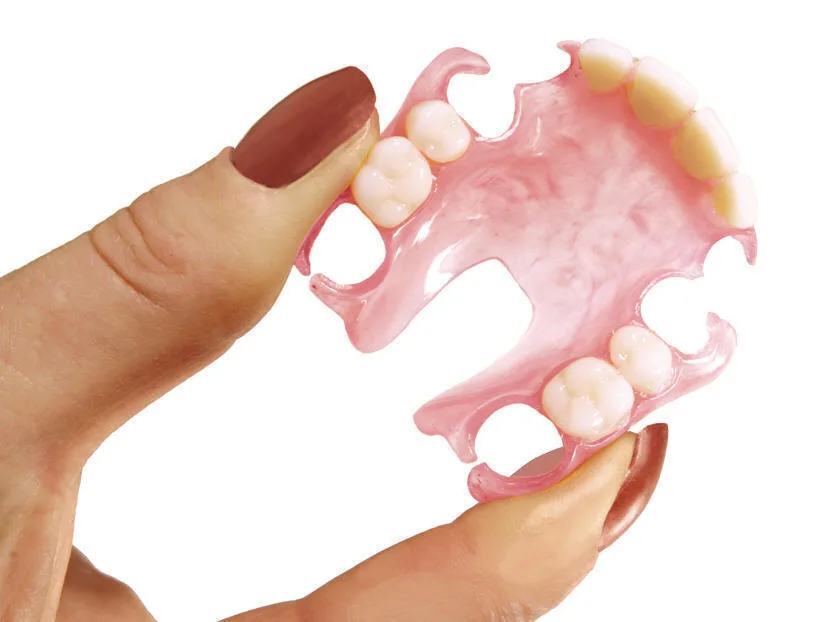 valplast denture