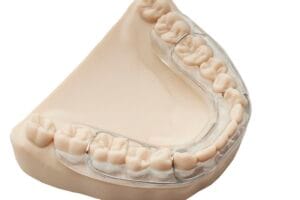 Clear removable retainer on model